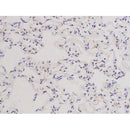 AF0198 at 1/200 staining Rat lung tissue sections by IHC-P. The tissue was formaldehyde fixed and a heat mediated antigen retrieval step in citrate buffer was performed. The tissue was then blocked and incubated with the antibody for 1.5 hours at 22¡ãC. An HRP conjugated goat anti-rabbit antibody was used as the secondary