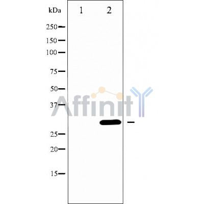 Western blot analysis of extracts from HEK293 cells, using ELNE Antibody. The lane on the left was treated with blocking peptide.