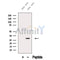 Western blot analysis of extracts from HEK-293 cells, using ELNE Antibody. The lane on the left was treated with blocking peptide.