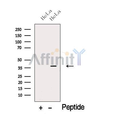 Western blot analysis of extracts from HeLa cells, using CAPG Antibody. The lane on the left was treated with blocking peptide.