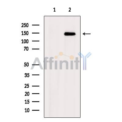 Western blot analysis of extracts from 3T3, using eNOS Antibody. The lane on the left was treated with blocking peptide.