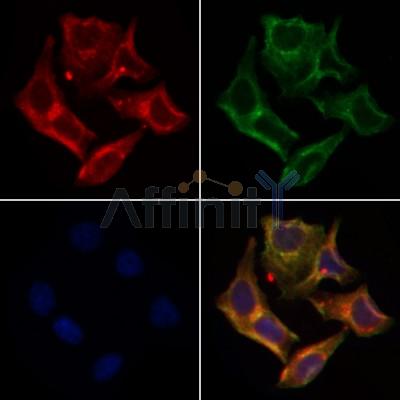 AF0111 staining Hela by IF/ICC. The samples were fixed with PFA and permeabilized in 0.1% Triton X-100,then blocked in 10% serum for 45 minutes at 25¡ãC. Samples were then incubated with primary Ab(AF0111 1:200) and mouse anti-beta tubulin Ab(T0023 1:200) for 1 hour at 37¡ãC. An  AlexaFluor594 conjugated goat anti-rabbit IgG(H+L) Ab(S0006 1:200 Red) and an AlexaFluor488 conjugated goat anti-mouse IgG(H+L) Ab(S0017 1:600 Green) were used as the secondary antibod