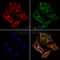 AF0111 staining Hela by IF/ICC. The samples were fixed with PFA and permeabilized in 0.1% Triton X-100,then blocked in 10% serum for 45 minutes at 25¡ãC. Samples were then incubated with primary Ab(AF0111 1:200) and mouse anti-beta tubulin Ab(T0023 1:200) for 1 hour at 37¡ãC. An  AlexaFluor594 conjugated goat anti-rabbit IgG(H+L) Ab(S0006 1:200 Red) and an AlexaFluor488 conjugated goat anti-mouse IgG(H+L) Ab(S0017 1:600 Green) were used as the secondary antibod