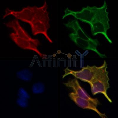 AF0117 staining Hela by IF/ICC. The samples were fixed with PFA and permeabilized in 0.1% Triton X-100,then blocked in 10% serum for 45 minutes at 25¡ãC. Samples were then incubated with primary Ab(AF0117 1:200) and mouse anti-beta tubulin Ab(T0023 1:200) for 1 hour at 37¡ãC. An  AlexaFluor594 conjugated goat anti-rabbit IgG(H+L) Ab(S0006 1:200 Red) and an AlexaFluor488 conjugated goat anti-mouse IgG(H+L) Ab(S0017 1:600 Green) were used as the secondary antibod