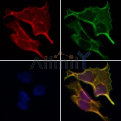 AF0117 staining Hela by IF/ICC. The samples were fixed with PFA and permeabilized in 0.1% Triton X-100,then blocked in 10% serum for 45 minutes at 25¡ãC. Samples were then incubated with primary Ab(AF0117 1:200) and mouse anti-beta tubulin Ab(T0023 1:200) for 1 hour at 37¡ãC. An  AlexaFluor594 conjugated goat anti-rabbit IgG(H+L) Ab(S0006 1:200 Red) and an AlexaFluor488 conjugated goat anti-mouse IgG(H+L) Ab(S0017 1:600 Green) were used as the secondary antibod