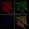 AF0117 staining Hela by IF/ICC. The samples were fixed with PFA and permeabilized in 0.1% Triton X-100,then blocked in 10% serum for 45 minutes at 25¡ãC. Samples were then incubated with primary Ab(AF0117 1:200) and mouse anti-beta tubulin Ab(T0023 1:200) for 1 hour at 37¡ãC. An  AlexaFluor594 conjugated goat anti-rabbit IgG(H+L) Ab(S0006 1:200 Red) and an AlexaFluor488 conjugated goat anti-mouse IgG(H+L) Ab(S0017 1:600 Green) were used as the secondary antibod