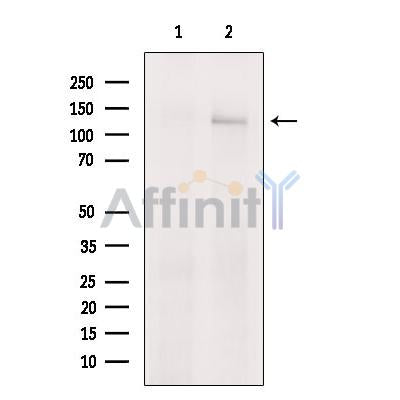 Western blot analysis of extracts from Mouse  lung, using E-cadherin Antibody. The lane on the left was treated with blocking peptide.