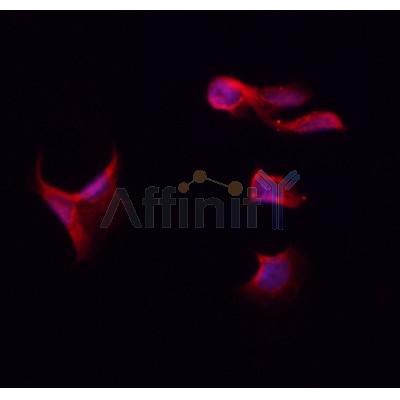 AF0141 staining Hela by IF/ICC. The sample were fixed with PFA and permeabilized in 0.1% Triton X-100,then blocked in 10% serum for 45 minutes at 25¡ãC. The primary antibody was diluted at 1/200 and incubated with the sample for 1 hour at 37¡ãC. An  Alexa Fluor 594 conjugated goat anti-rabbit IgG (H+L) Ab, diluted at 1/600, was used as the secondary antibod