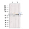 Western blot analysis of extracts from 293, using TFDP1 Antibody. Lane 1 was treated with the blocking peptide.