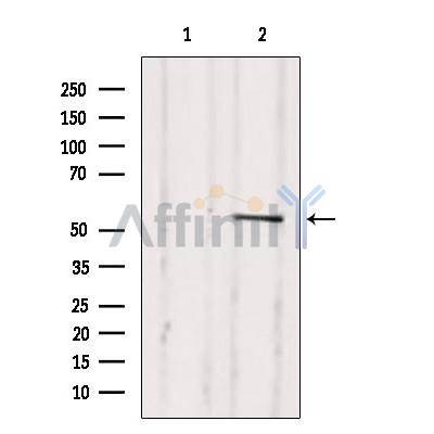 Western blot analysis of extracts from 293, using TFDP1 Antibody. Lane 1 was treated with the blocking peptide.