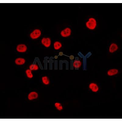 AF0149 staining Hela by IF/ICC. The sample were fixed with PFA and permeabilized in 0.1% Triton X-100,then blocked in 10% serum for 45 minutes at 25¡ãC. The primary antibody was diluted at 1/200 and incubated with the sample for 1 hour at 37¡ãC. An  Alexa Fluor 594 conjugated goat anti-rabbit IgG (H+L) Ab, diluted at 1/600, was used as the secondary antibod