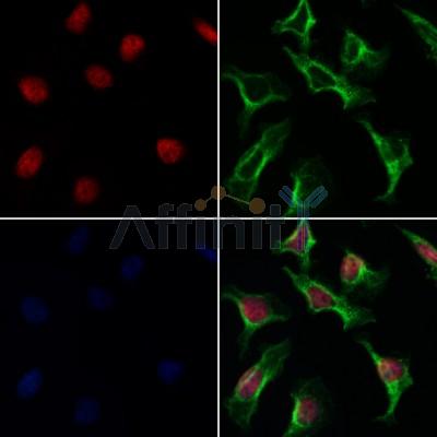 AF0151 staining Hela by IF/ICC. The samples were fixed with PFA and permeabilized in 0.1% Triton X-100,then blocked in 10% serum for 45 minutes at 25¡ãC. Samples were then incubated with primary Ab(AF0151 1:200) and mouse anti-beta tubulin Ab(T0023 1:200) for 1 hour at 37¡ãC. An  AlexaFluor594 conjugated goat anti-rabbit IgG(H+L) Ab(S0006 1:200 Red) and an AlexaFluor488 conjugated goat anti-mouse IgG(H+L) Ab(S0017 1:600 Green) were used as the secondary antibod