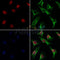 AF0151 staining Hela by IF/ICC. The samples were fixed with PFA and permeabilized in 0.1% Triton X-100,then blocked in 10% serum for 45 minutes at 25¡ãC. Samples were then incubated with primary Ab(AF0151 1:200) and mouse anti-beta tubulin Ab(T0023 1:200) for 1 hour at 37¡ãC. An  AlexaFluor594 conjugated goat anti-rabbit IgG(H+L) Ab(S0006 1:200 Red) and an AlexaFluor488 conjugated goat anti-mouse IgG(H+L) Ab(S0017 1:600 Green) were used as the secondary antibod