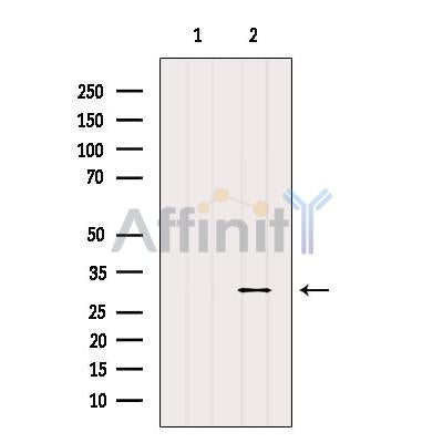 Western blot analysis of extracts from Mouse muscle, using E2F6 Antibody. The lane on the left was treated with blocking peptide.