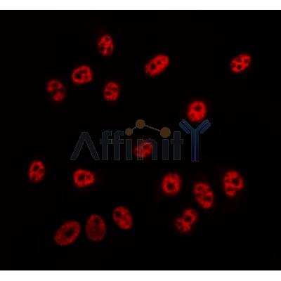 AF0152 staining Hela by IF/ICC. The sample were fixed with PFA and permeabilized in 0.1% Triton X-100,then blocked in 10% serum for 45 minutes at 25¡ãC. The primary antibody was diluted at 1/200 and incubated with the sample for 1 hour at 37¡ãC. An  Alexa Fluor 594 conjugated goat anti-rabbit IgG (H+L) Ab, diluted at 1/600, was used as the secondary antibod