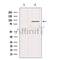 Western blot analysis of extracts from HepG2, using FGFR2 Antibody. Lane 1 was treated with the blocking peptide.