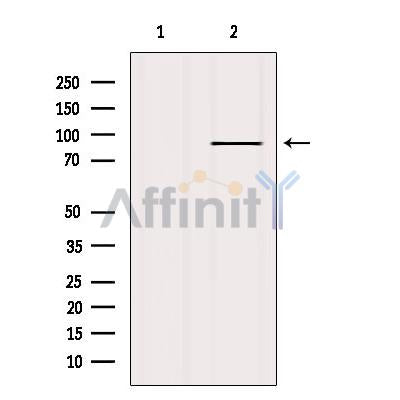 Western blot analysis of extracts from HepG2, using FGFR2 Antibody. Lane 1 was treated with the blocking peptide.
