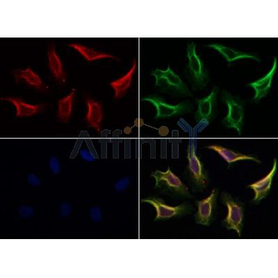 AF0160 staining Hela by IF/ICC. The samples were fixed with PFA and permeabilized in 0.1% Triton X-100,then blocked in 10% serum for 45 minutes at 25¡ãC. Samples were then incubated with primary Ab(AF0160 1:200) and mouse anti-beta tubulin Ab(T0023 1:200) for 1 hour at 37¡ãC. An  AlexaFluor594 conjugated goat anti-rabbit IgG(H+L) Ab(S0006 1:200 Red) and an AlexaFluor488 conjugated goat anti-mouse IgG(H+L) Ab(S0017 1:600 Green) were used as the secondary antibod
