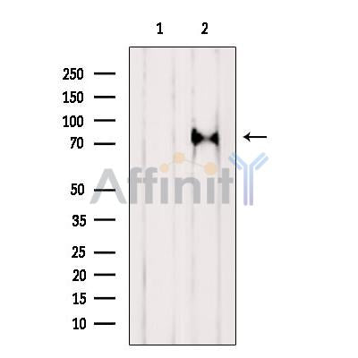 Western blot analysis of extracts from 3T3, using mGluR7 Antibody. The lane on the left was treated with blocking peptide.

Observed bands: 80 kDa.