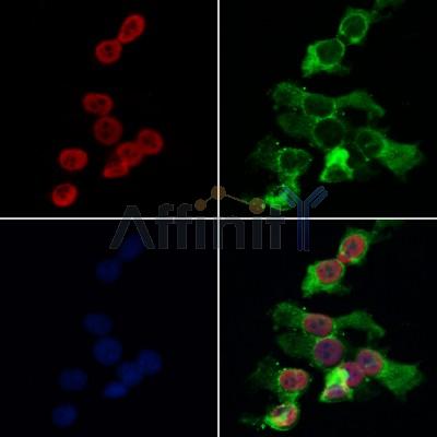AF0178 staining HepG2 by IF/ICC. The samples were fixed with PFA and permeabilized in 0.1% Triton X-100,then blocked in 10% serum for 45 minutes at 25¡ãC. Samples were then incubated with primary Ab(AF0178 1:200) and mouse anti-beta tubulin Ab(T0023 1:200) for 1 hour at 37¡ãC. An  AlexaFluor594 conjugated goat anti-rabbit IgG(H+L) Ab(S0006 1:200 Red) and an AlexaFluor488 conjugated goat anti-mouse IgG(H+L) Ab(S0017 1:600 Green) were used as the secondary antibody