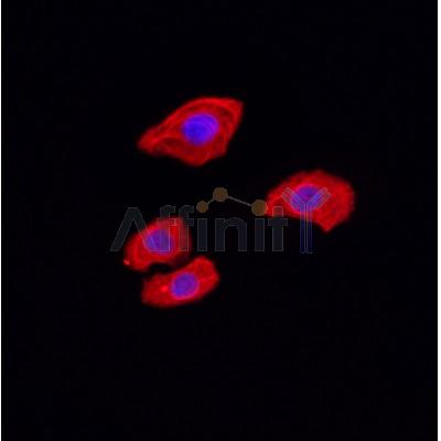 AF0191 staining Hela by IF/ICC. The sample were fixed with PFA and permeabilized in 0.1% Triton X-100,then blocked in 10% serum for 45 minutes at 25¡ãC. The primary antibody was diluted at 1/200 and incubated with the sample for 1 hour at 37¡ãC. An  Alexa Fluor 594 conjugated goat anti-rabbit IgG (H+L) Ab, diluted at 1/600, was used as the secondary antibod