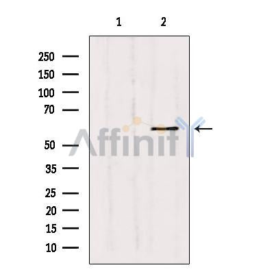 Western blot analysis of extracts from Hepg2, using MMP11 Antibody. Lane 1 was treated with the blocking peptide.