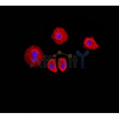 AF0216 staining Hela by IF/ICC. The sample were fixed with PFA and permeabilized in 0.1% Triton X-100,then blocked in 10% serum for 45 minutes at 25¡ãC. The primary antibody was diluted at 1/200 and incubated with the sample for 1 hour at 37¡ãC. An  Alexa Fluor 594 conjugated goat anti-rabbit IgG (H+L) Ab, diluted at 1/600, was used as the secondary antibod