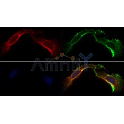 AF0217 staining Hela by IF/ICC. The samples were fixed with PFA and permeabilized in 0.1% Triton X-100,then blocked in 10% serum for 45 minutes at 25¡ãC. Samples were then incubated with primary Ab(AF0217 1:200) and mouse anti-beta tubulin Ab(T0023 1:200) for 1 hour at 37¡ãC. An  AlexaFluor594 conjugated goat anti-rabbit IgG(H+L) Ab(S0006 1:200 Red) and an AlexaFluor488 conjugated goat anti-mouse IgG(H+L) Ab(S0017 1:600 Green) were used as the secondary antibod