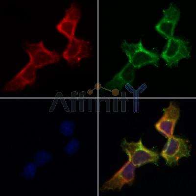 AF0242 staining Hela by IF/ICC. The samples were fixed with PFA and permeabilized in 0.1% Triton X-100,then blocked in 10% serum for 45 minutes at 25¡ãC. Samples were then incubated with primary Ab(AF0242 1:200) and mouse anti-beta tubulin Ab(T0023 1:200) for 1 hour at 37¡ãC. An  AlexaFluor594 conjugated goat anti-rabbit IgG(H+L) Ab(S0006 1:200 Red) and an AlexaFluor488 conjugated goat anti-mouse IgG(H+L) Ab(S0017 1:600 Green) were used as the secondary antibod
