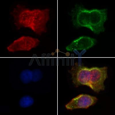 AF0247 staining HepG2 by IF/ICC. The samples were fixed with PFA and permeabilized in 0.1% Triton X-100,then blocked in 10% serum for 45 minutes at 25¡ãC. Samples were then incubated with primary Ab(AF0247 1:200) and mouse anti-beta tubulin Ab(T0023 1:200) for 1 hour at 37¡ãC. An  AlexaFluor594 conjugated goat anti-rabbit IgG(H+L) Ab(S0006 1:200 Red) and an AlexaFluor488 conjugated goat anti-mouse IgG(H+L) Ab(S0017 1:600 Green) were used as the secondary antibod