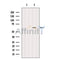 Western blot analysis of extracts from K562, using RCBTB1 Antibody. The lane on the left was treated with blocking peptide.