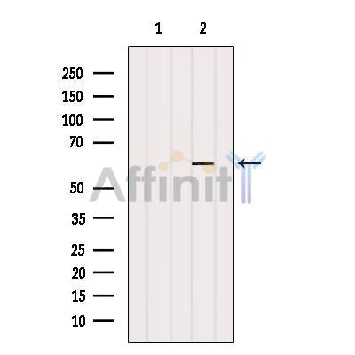 Western blot analysis of extracts from K562, using RCBTB1 Antibody. The lane on the left was treated with blocking peptide.