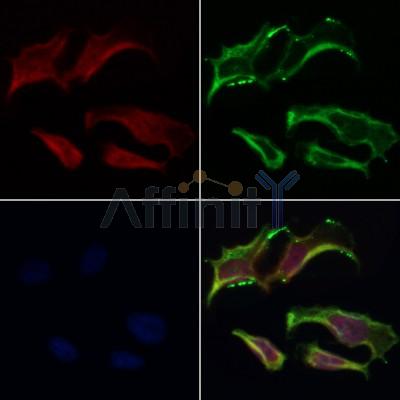 AF0255 staining Hela by IF/ICC. The samples were fixed with PFA and permeabilized in 0.1% Triton X-100,then blocked in 10% serum for 45 minutes at 25¡ãC. Samples were then incubated with primary Ab(AF0255 1:200) and mouse anti-beta tubulin Ab(T0023 1:200) for 1 hour at 37¡ãC. An  AlexaFluor594 conjugated goat anti-rabbit IgG(H+L) Ab(S0006 1:200 Red) and an AlexaFluor488 conjugated goat anti-mouse IgG(H+L) Ab(S0017 1:600 Green) were used as the secondary antibod