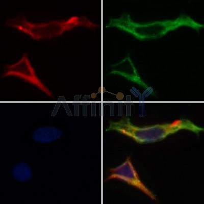 AF0259 staining Hela by IF/ICC. The samples were fixed with PFA and permeabilized in 0.1% Triton X-100,then blocked in 10% serum for 45 minutes at 25¡ãC. Samples were then incubated with primary Ab(AF0259 1:200) and mouse anti-beta tubulin Ab(T0023 1:200) for 1 hour at 37¡ãC. An  AlexaFluor594 conjugated goat anti-rabbit IgG(H+L) Ab(S0006 1:200 Red) and an AlexaFluor488 conjugated goat anti-mouse IgG(H+L) Ab(S0017 1:600 Green) were used as the secondary antibod