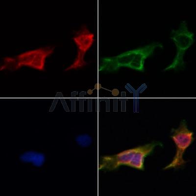 AF0275 staining HepG2 by IF/ICC. The samples were fixed with PFA and permeabilized in 0.1% Triton X-100,then blocked in 10% serum for 45 minutes at 25¡ãC. Samples were then incubated with primary Ab(AF0275 1:200) and mouse anti-beta tubulin Ab(T0023 1:200) for 1 hour at 37¡ãC. An  AlexaFluor594 conjugated goat anti-rabbit IgG(H+L) Ab(S0006 1:200 Red) and an AlexaFluor488 conjugated goat anti-mouse IgG(H+L) Ab(S0017 1:600 Green) were used as the secondary antibod