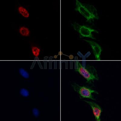 AF0280 staining HepG2 by IF/ICC. The samples were fixed with PFA and permeabilized in 0.1% Triton X-100,then blocked in 10% serum for 45 minutes at 25¡ãC. Samples were then incubated with primary Ab(AF0280 1:200) and mouse anti-beta tubulin Ab(T0023 1:200) for 1 hour at 37¡ãC. An  AlexaFluor594 conjugated goat anti-rabbit IgG(H+L) Ab(S0006 1:200 Red) and an AlexaFluor488 conjugated goat anti-mouse IgG(H+L) Ab(S0017 1:600 Green) were used as the secondary antibod