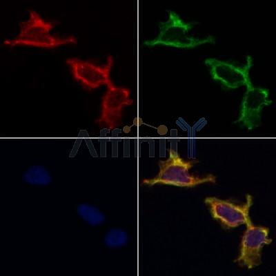 AF0289 staining HepG2 by IF/ICC. The samples were fixed with PFA and permeabilized in 0.1% Triton X-100,then blocked in 10% serum for 45 minutes at 25¡ãC. Samples were then incubated with primary Ab(AF0289 1:200) and mouse anti-beta tubulin Ab(T0023 1:200) for 1 hour at 37¡ãC. An  AlexaFluor594 conjugated goat anti-rabbit IgG(H+L) Ab(S0006 1:200 Red) and an AlexaFluor488 conjugated goat anti-mouse IgG(H+L) Ab(S0017 1:600 Green) were used as the secondary antibod