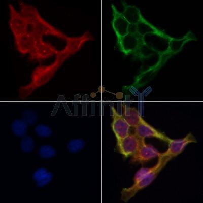 AF0298 staining Hela by IF/ICC. The samples were fixed with PFA and permeabilized in 0.1% Triton X-100,then blocked in 10% serum for 45 minutes at 25¡ãC. Samples were then incubated with primary Ab(AF0298 1:200) and mouse anti-beta tubulin Ab(T0023 1:200) for 1 hour at 37¡ãC. An  AlexaFluor594 conjugated goat anti-rabbit IgG(H+L) Ab(S0006 1:200 Red) and an AlexaFluor488 conjugated goat anti-mouse IgG(H+L) Ab(S0017 1:600 Green) were used as the secondary antibod