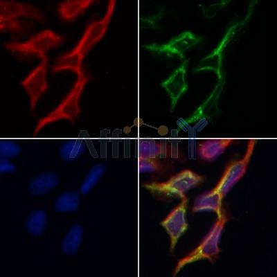 AF0310 staining Hela by IF/ICC. The samples were fixed with PFA and permeabilized in 0.1% Triton X-100,then blocked in 10% serum for 45 minutes at 25¡ãC. Samples were then incubated with primary Ab(AF0310 1:200) and mouse anti-beta tubulin Ab(T0023 1:200) for 1 hour at 37¡ãC. An  AlexaFluor594 conjugated goat anti-rabbit IgG(H+L) Ab(S0006 1:200 Red) and an AlexaFluor488 conjugated goat anti-mouse IgG(H+L) Ab(S0017 1:600 Green) were used as the secondary antibod
