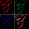 AF0310 staining Hela by IF/ICC. The samples were fixed with PFA and permeabilized in 0.1% Triton X-100,then blocked in 10% serum for 45 minutes at 25¡ãC. Samples were then incubated with primary Ab(AF0310 1:200) and mouse anti-beta tubulin Ab(T0023 1:200) for 1 hour at 37¡ãC. An  AlexaFluor594 conjugated goat anti-rabbit IgG(H+L) Ab(S0006 1:200 Red) and an AlexaFluor488 conjugated goat anti-mouse IgG(H+L) Ab(S0017 1:600 Green) were used as the secondary antibod