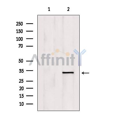 Western blot analysis of extracts from mouse brain, using OVOL1 Antibody. Lane 1 was treated with the blocking peptide.