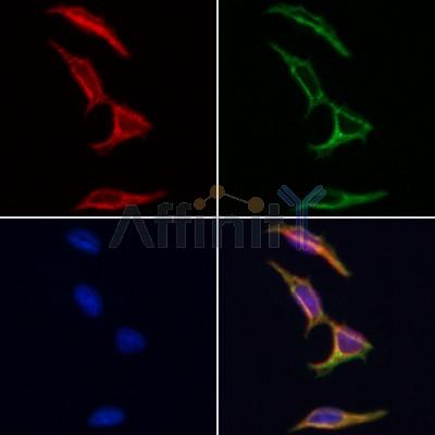 AF0316 staining Hela by IF/ICC. The samples were fixed with PFA and permeabilized in 0.1% Triton X-100,then blocked in 10% serum for 45 minutes at 25¡ãC. Samples were then incubated with primary Ab(AF0316 1:200) and mouse anti-beta tubulin Ab(T0023 1:200) for 1 hour at 37¡ãC. An  AlexaFluor594 conjugated goat anti-rabbit IgG(H+L) Ab(S0006 1:200 Red) and an AlexaFluor488 conjugated goat anti-mouse IgG(H+L) Ab(S0017 1:600 Green) were used as the secondary antibod