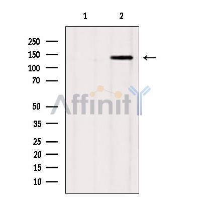 Western blot analysis of extracts from mouse brain, using GAK Antibody. Lane 1 was treated with the blocking peptide.