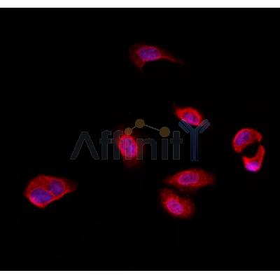 AF0320 staining Hela by IF/ICC. The sample were fixed with PFA and permeabilized in 0.1% Triton X-100,then blocked in 10% serum for 45 minutes at 25¡ãC. The primary antibody was diluted at 1/200 and incubated with the sample for 1 hour at 37¡ãC. An  Alexa Fluor 594 conjugated goat anti-rabbit IgG (H+L) Ab, diluted at 1/600, was used as the secondary antibod