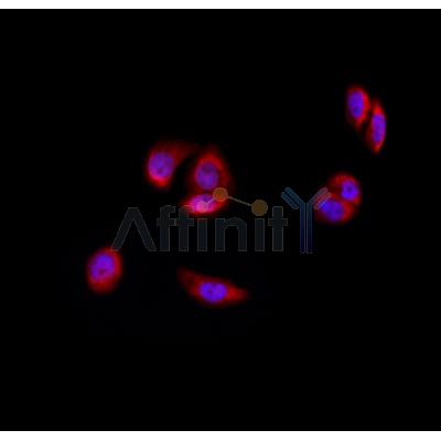 AF0335 staining Hela by IF/ICC. The sample were fixed with PFA and permeabilized in 0.1% Triton X-100,then blocked in 10% serum for 45 minutes at 25¡ãC. The primary antibody was diluted at 1/200 and incubated with the sample for 1 hour at 37¡ãC. An  Alexa Fluor 594 conjugated goat anti-rabbit IgG (H+L) Ab, diluted at 1/600, was used as the secondary antibod