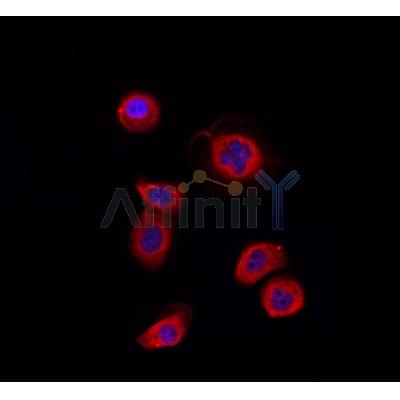 AF0354 staining Hela by IF/ICC. The sample were fixed with PFA and permeabilized in 0.1% Triton X-100,then blocked in 10% serum for 45 minutes at 25¡ãC. The primary antibody was diluted at 1/200 and incubated with the sample for 1 hour at 37¡ãC. An  Alexa Fluor 594 conjugated goat anti-rabbit IgG (H+L) Ab, diluted at 1/600, was used as the secondary antibod