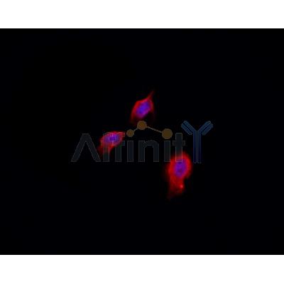 AF0361 staining Hela by IF/ICC. The sample were fixed with PFA and permeabilized in 0.1% Triton X-100,then blocked in 10% serum for 45 minutes at 25¡ãC. The primary antibody was diluted at 1/200 and incubated with the sample for 1 hour at 37¡ãC. An  Alexa Fluor 594 conjugated goat anti-rabbit IgG (H+L) Ab, diluted at 1/600, was used as the secondary antibod