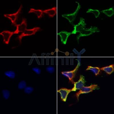 AF0362 staining Hela by IF/ICC. The samples were fixed with PFA and permeabilized in 0.1% Triton X-100,then blocked in 10% serum for 45 minutes at 25¡ãC. Samples were then incubated with primary Ab(AF0362 1:200) and mouse anti-beta tubulin Ab(T0023 1:200) for 1 hour at 37¡ãC. An  AlexaFluor594 conjugated goat anti-rabbit IgG(H+L) Ab(S0006 1:200 Red) and an AlexaFluor488 conjugated goat anti-mouse IgG(H+L) Ab(S0017 1:600 Green) were used as the secondary antibod
