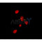 AF0363 staining Hela by IF/ICC. The sample were fixed with PFA and permeabilized in 0.1% Triton X-100,then blocked in 10% serum for 45 minutes at 25¡ãC. The primary antibody was diluted at 1/200 and incubated with the sample for 1 hour at 37¡ãC. An  Alexa Fluor 594 conjugated goat anti-rabbit IgG (H+L) Ab, diluted at 1/600, was used as the secondary antibod