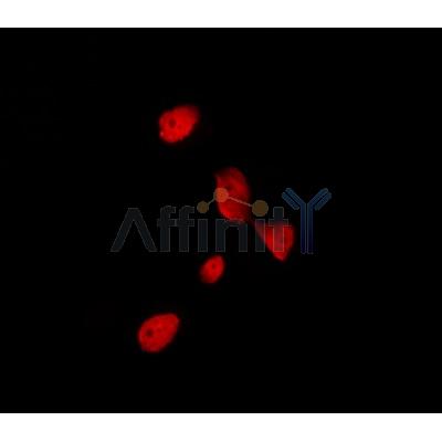 AF0363 staining Hela by IF/ICC. The sample were fixed with PFA and permeabilized in 0.1% Triton X-100,then blocked in 10% serum for 45 minutes at 25¡ãC. The primary antibody was diluted at 1/200 and incubated with the sample for 1 hour at 37¡ãC. An  Alexa Fluor 594 conjugated goat anti-rabbit IgG (H+L) Ab, diluted at 1/600, was used as the secondary antibod